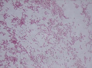 Pseudomonas Fluorescens Nbrc